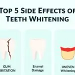 Infographic illustrating the top 5 side effects of teeth whitening: tooth sensitivity, gum irritation, enamel damage, uneven whitening, and allergic reactions.