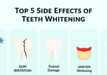 Infographic illustrating the top 5 side effects of teeth whitening: tooth sensitivity, gum irritation, enamel damage, uneven whitening, and allergic reactions.