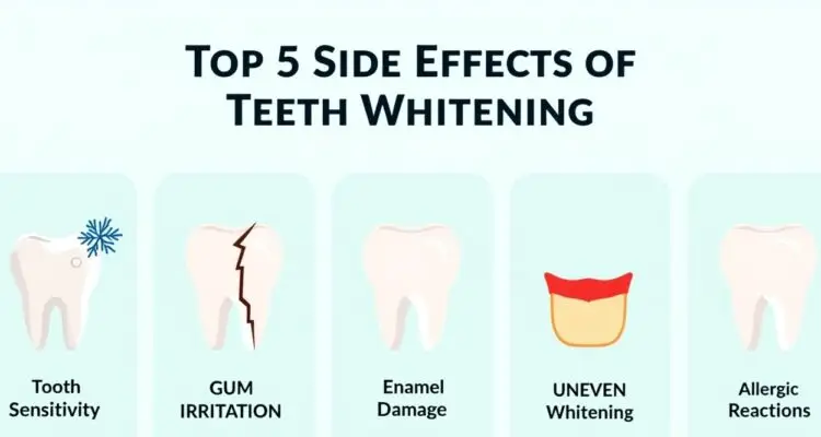Infographic illustrating the top 5 side effects of teeth whitening: tooth sensitivity, gum irritation, enamel damage, uneven whitening, and allergic reactions.