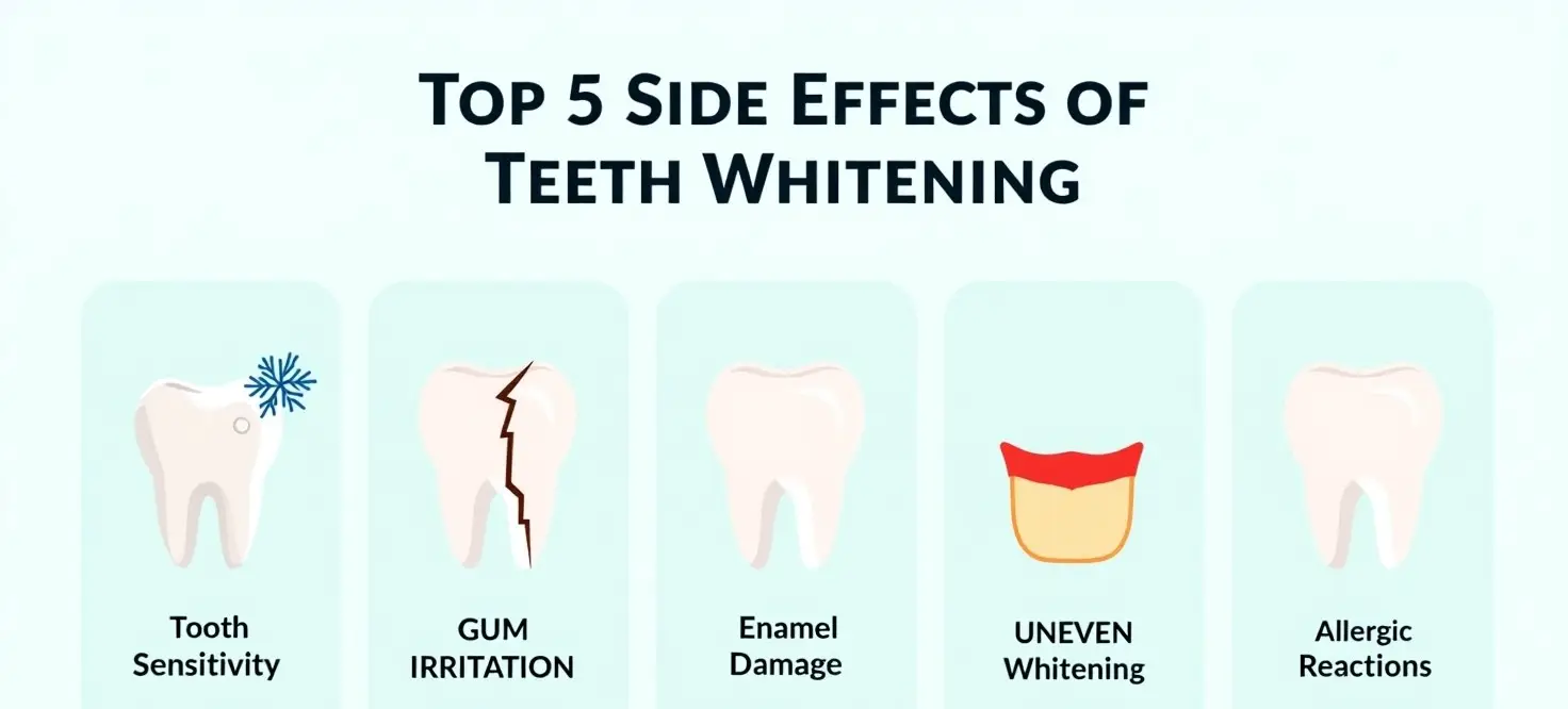 Infographic illustrating the top 5 side effects of teeth whitening: tooth sensitivity, gum irritation, enamel damage, uneven whitening, and allergic reactions.