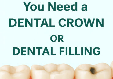 Educational graphic showing tooth icons with mild decay, representing the comparison between dental crowns and fillings.