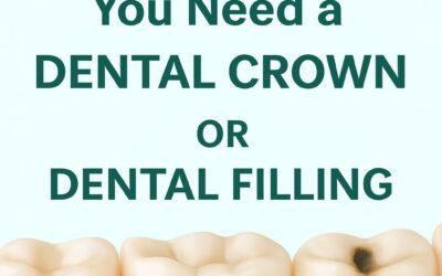 Educational graphic showing tooth icons with mild decay, representing the comparison between dental crowns and fillings.